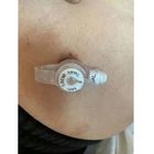 Στεριλή σιλικόνη μίας χρήσης ενδοτραχείο σωλήνα κουμπί γαστροστομία για ενήλικες
